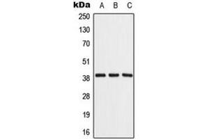 Western blot analysis of ALDOB expression in Raji (A), NIH3T3 (B), rat liver (C) whole cell lysates.