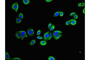 Immunofluorescent analysis of HepG2 cells using ABIN7172377 at dilution of 1:100 and Alexa Fluor 488-congugated AffiniPure Goat Anti-Rabbit IgG(H+L) (TRAPPC9 antibody  (AA 780-1030))