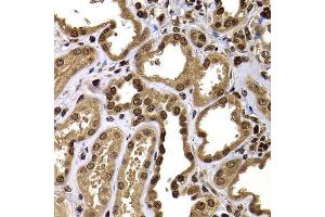 Immunohistochemistry of paraffin-embedded human kidney using GPS1 antibody at dilution of 1:100 (x400 lens). (GPS1 antibody)