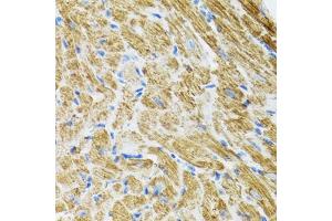 Immunohistochemistry of paraffin-embedded rat heart using POLG2 antibody (ABIN5974040) at dilution of 1/100 (40x lens). (POLG2 antibody)