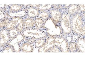 Detection of IL18R1 in Human Kidney Tissue using Monoclonal Antibody to Interleukin 18 Receptor 1 (IL18R1) (IL18R1 antibody  (AA 375-428))
