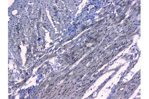 IHC analysis of MAX using anti-MAX antibody . (MAX antibody  (AA 30-106))