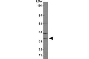 Western blot of ABHD5 in MCF-7 cell lysates using ABHD5 polyclonal antibody . (ABHD5 antibody  (AA 200-300))