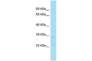 Host: Rabbit Target Name: TPD52L2 Sample Type: U937 Whole Cell lysates Antibody Dilution: 1. (TPD52L2 antibody  (Middle Region))