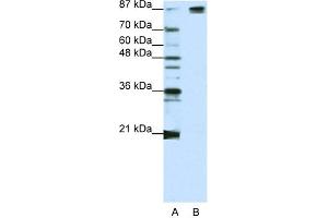 WB Suggested Anti-SF3B1 Antibody Titration:  1.