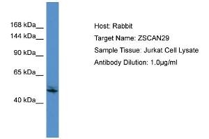 Host:  Rabbit  Target Name:  ZSCAN29  Sample Type:  Jurkat Whole Cell lysates  Antibody Dilution:  1. (ZSCAN29 antibody  (C-Term))