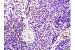 Paraformaldehyde-fixed, paraffin embedded rat spleen tissue, Antigen retrieval by boiling in sodium citrate buffer(pH6) for 15min, Block endogenous peroxidase by 3% hydrogen peroxide for 30 minutes, Blocking buffer (normal goat serum) at 37°C for 20min, Antibody incubation with Rabbit Anti-LAT (Tyr161) Polyclonal Antibody, Unconjugated  at 1:400 overnight at 4°C, followed by a conjugated secondary and DAB staining (LAT antibody  (pTyr161))