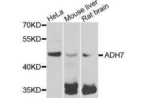 Western blot analysis of extracts of various cells, using ADH7 antibody. (ADH7 antibody)