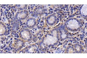 Detection of PIK3C2a in Human Stomach Tissue using Polyclonal Antibody to Phosphoinositide-3-Kinase Class-2-Alpha Polypeptide (PIK3C2a)