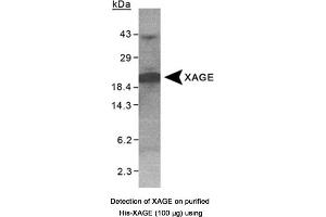 Image no. 1 for anti-X Antigen Family, Member 1D (XAGE1D) antibody (ABIN363336) (XAGE1D antibody)