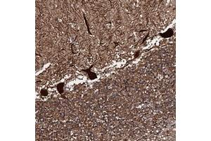 Immunohistochemical staining of human cerebellum with C18orf32 polyclonal antibody  shows strong cytoplasmic and nuclear positivity in purkinje cells at 1:20-1:50 dilution.