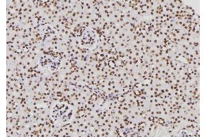 ABIN6276831 at 1/100 staining Rat kidney tissue by IHC-P. (CTBP1 antibody  (Internal Region))