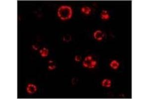 AP20063PU-N ATG16 antibody staining of HeLa Cell Lysate by Immunofluorescence at 4. (ATG16L1 antibody  (N-Term))