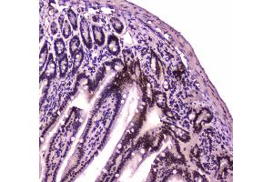 IHC analysis of BRG1 using anti-BRG1 antibody . (SMARCA4 antibody  (AA 555-763))