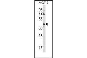 Western blot analysis of GNA14 Antibody (N-term) in MCF-7 cell line lysates (35ug/lane). (GNa14 antibody  (N-Term))