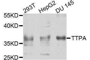 Western blot analysis of extracts of various cells, using TTPA antibody. (TTPA antibody)