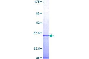 TSG101 Protein (AA 201-280) (GST tag)