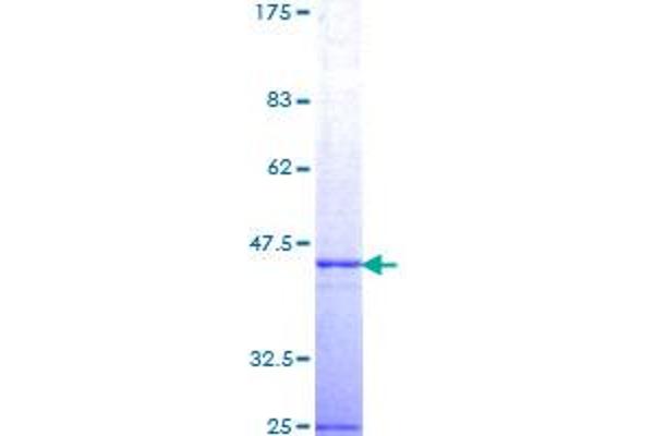TSG101 Protein (AA 201-280) (GST tag)