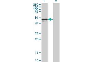 Western Blot analysis of CALR expression in transfected 293T cell line by CALR monoclonal antibody (M01), clone 1G11-1A9. (Calreticulin antibody  (AA 1-417))