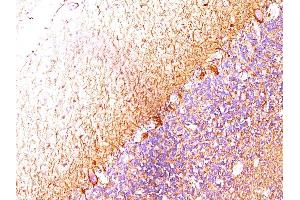 Formalin-fixed, paraffin-embedded cerebellum stained with Neurofilament Monoclonal Antibody (SPM204). (NEFL antibody)