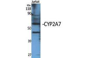 Western Blotting (WB) image for anti-Cytochrome P450, Family 2, Subfamily A, Polypeptide 7 (CYP2A7) (C-Term) antibody (ABIN3184174) (CYP2A7 antibody  (C-Term))