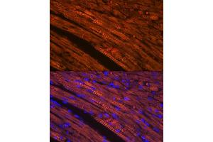 Immunofluorescence (IF) image for anti-Cardiac Troponin T (cTnT) antibody (ABIN7266088)