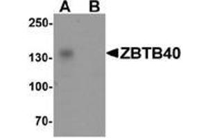 Western blot analysis of ZBTB40 in Raji cell lysate with ZBTB40 Antibody  at 0.