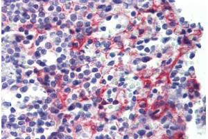 Human Spleen (formalin-fixed, paraffin-embedded) stained with PDGFRB antibody ABIN462353 followed by biotinylated anti-mouse IgG secondary antibody ABIN481714, alkaline phosphatase-streptavidin and chromogen. (PDGFRB antibody)