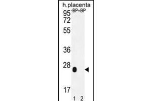 Western blot analysis of OR2J3 Antibody Pab pre-incubated without(lane 1) and with(lane 2) blocking peptide in human placenta tissue lysate. (OR2J3 antibody  (C-Term))