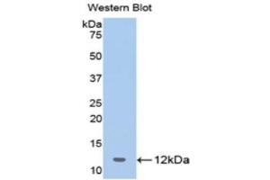 Western Blotting (WB) image for anti-2',5'-Oligoadenylate Synthetase 1, 40/46kDa (OAS1) (AA 74-165) antibody (ABIN1175790) (OAS1 antibody  (AA 74-165))