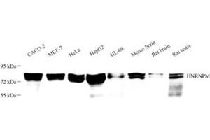 Western blot analysis of HNRNPM (ABIN7074247) at dilution of 1: 3000 (HnRNP M1-M4 antibody)