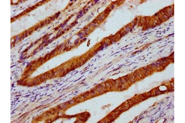 PARS2 antibody  (AA 126-258)