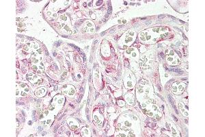 Anti-RARRES3 antibody IHC of human placenta. (RARRES3 antibody  (AA 124-136))