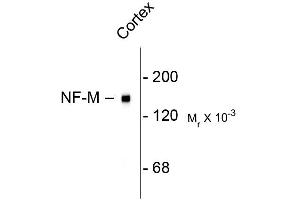 Western blots of rat cortex lysate showing specific immunolableing of the ~ 145k NF-M protein. (NEFM antibody  (C-Term))