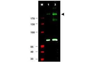 Western blot using IRS1 (phospho S307) polyclonal antibody  shows detection of a band at ~180 KDa believed to represent phosphorylated IRS1 (arrowhead). (IRS1 antibody  (pSer307))