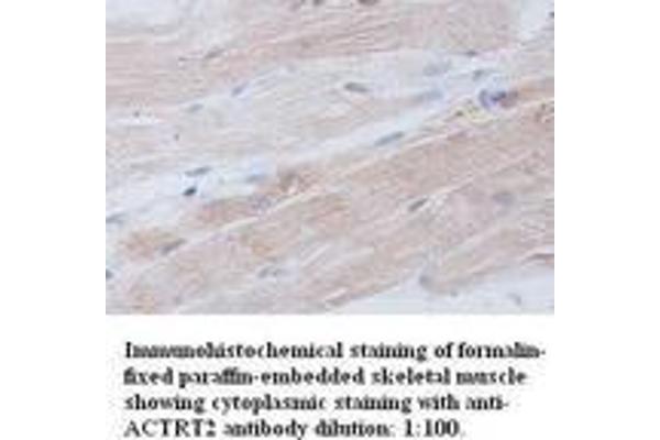 ACTRT2 antibody