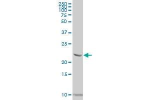 NACAL polyclonal antibody (A01), Lot # 061110JCS1 Western Blot analysis of NACAL expression in MES-SA/Dx5 . (NACA2 antibody  (AA 116-215))