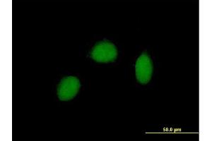 Immunofluorescence of purified MaxPab antibody to RALY on HeLa cell. (Raly antibody  (AA 1-307))