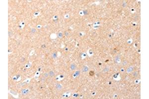 The image on the left is immunohistochemistry of paraffin-embedded Human brain tissue using ABIN7190883(GRM1 Antibody) at dilution 1/15, on the right is treated with synthetic peptide. (Metabotropic Glutamate Receptor 1 antibody)