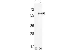 Western Blotting (WB) image for anti-Phosphatidylinositol-4-Phosphate 5-Kinase, Type I, alpha (PIP5K1A) antibody (ABIN3003646)