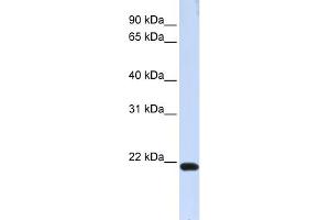 WB Suggested Anti-TJAP1 Antibody Titration:  0.
