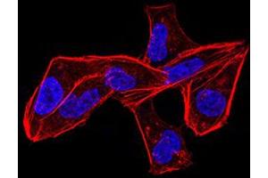 Immunocytochemistry (ICC) image for anti-Aldehyde Dehydrogenase 6 Family, Member A1 (ALDH6A1) (AA 1-195) antibody (ABIN5856297) (ALDH6A1 antibody  (AA 1-195))