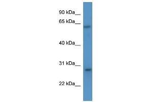 Cish antibody used at 0. (CISH antibody  (N-Term))