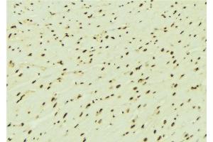 ABIN6276442 at 1/100 staining Mouse brain tissue by IHC-P. (RPA1 antibody  (Internal Region))