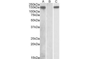 HEK293 lysate (10ug protein in RIPA buffer) overexpressing Human NLRP2 with DYKDDDDK tag probed with ABIN768539 (1ug/ml) in Lane A and probed with anti- DYKDDDDK Tag (1/1000) in lane C. (NLRP2 antibody  (C-Term))