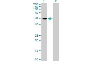 Western Blot analysis of IPPK expression in transfected 293T cell line by IPPK MaxPab polyclonal antibody.