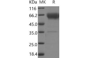 Western Blotting (WB) image for B and T Lymphocyte Associated (BTLA) (Active) protein (Fc Tag,ECD) (ABIN7321059) (BTLA Protein (Fc Tag,ECD))