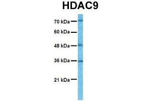 Western Blotting (WB) image for anti-Histone Deacetylase 9 (HDAC9) (C-Term) antibody (ABIN2775576)