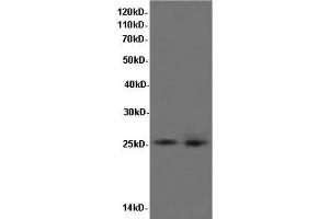 Western Blot analysis of K562 cells and Rat liver tissue using BCL-x Polyclonal Antibody at dilution of 1:600
