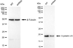 Western blotting analysis using crystallin α B antibody (ABIN7798169).